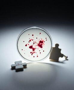 Common pneumonia bacterium may fuel Alzheimer’s disease - AI Generated Image